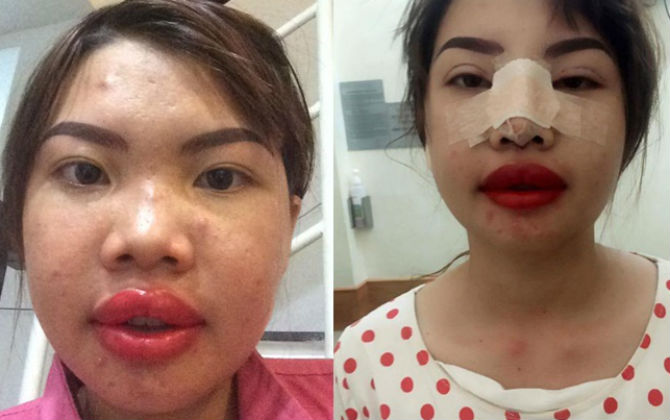 Bà mẹ đơn thân bị xa lánh vì xấu đã bất ngờ 'lột xác' sau quá trình 'đập đi xây lại nhan sắc'
