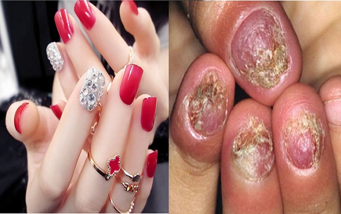 Đua nhau làm nail đẹp chào hè, chị em cần cảnh giác để không rước họa vào thân