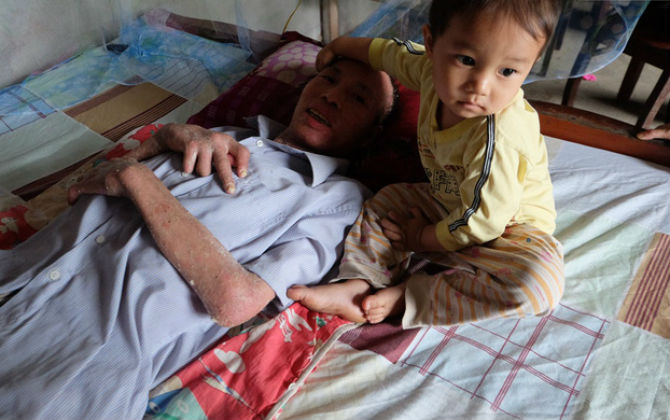 Cuộc sống khốn khó của người chồng liệt giường suốt 2 năm, từng muốn chết để vợ con bớt khổ