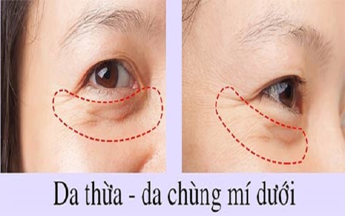 "Tuyệt chiêu" đơn giản xóa da nhăn nheo, chảy xệ, lão hóa nhanh cần áp dụng ngay hôm nay