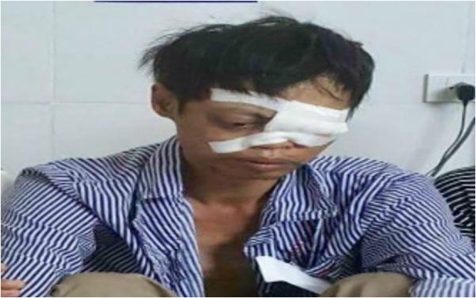 Ra tay giải hòa vụ xô xát, người bố nghèo có nguy cơ bị mù mắt khi mẹ già, con dại không ai chăm sóc