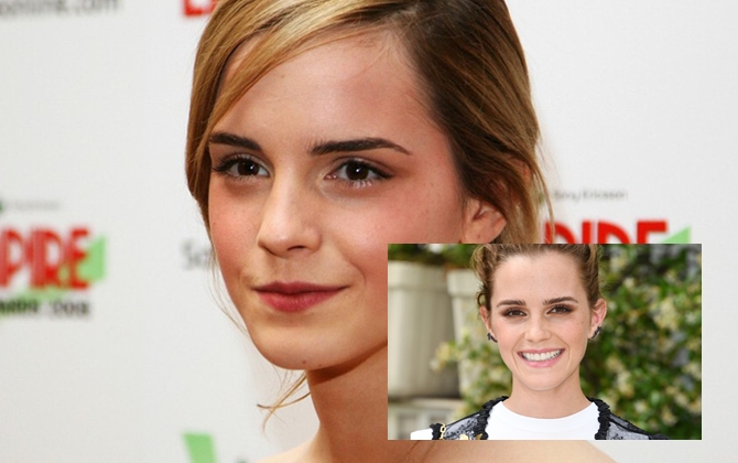 Emma Watson: "Hoa hồng đẹp nhất nước Anh" giờ bỗng tàn phai nhan sắc nhanh chóng