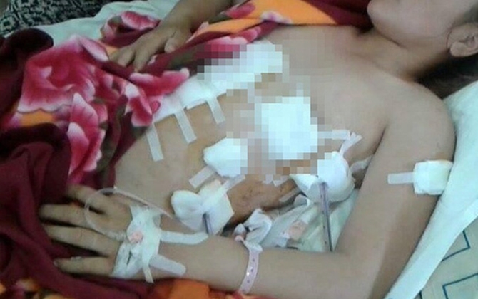 Đi gặp "bồ nhí" của chồng, người vợ bị đâm thương tích 75%