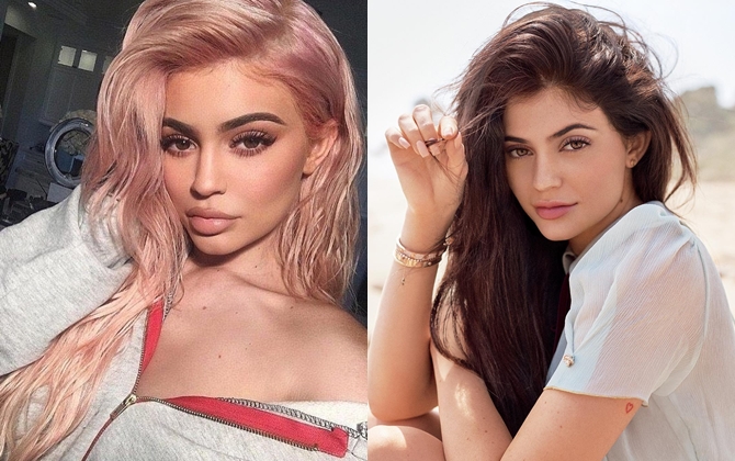 Ham tiêm môi tều như Kylie Jenner chị em cẩn thận thời kỳ mang thai sẽ cực kỳ nguy hiểm