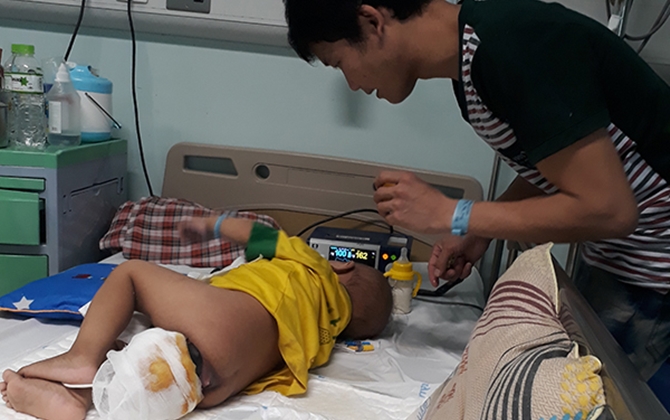 Xót lòng cậu bé 2 tuổi quấy khóc suốt ngày đêm vì mang khối u to như trái bưởi