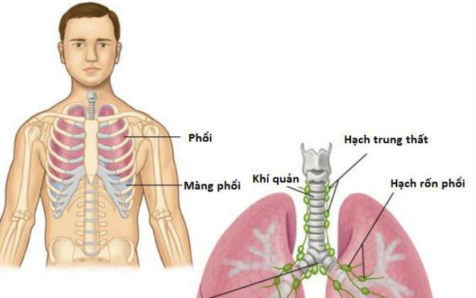 Căn bệnh rất khó phát hiện ở giai đoạn sớm, nhiều người đến viện đã giai đoạn muộn và nhận kết quả gây sốc