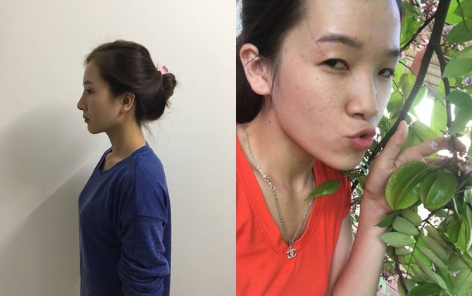 Màn lột xác bất ngờ của nữ sinh ĐH Y khoa Vinh từng bị nhà người yêu từ chối vì có "đôi mắt lươn"