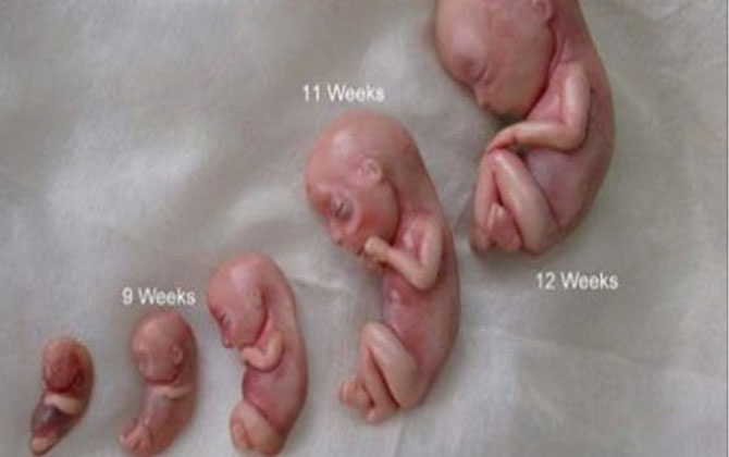 Bộ ảnh tuyệt đẹp về sự ra đời của một em bé