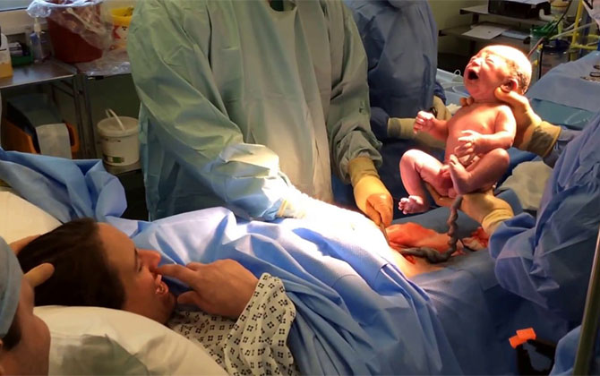 Chị em hí hửng lấy lại 'form bụng' nhanh chóng theo cách này nhưng bác sĩ lại chỉ rõ sự nguy hiểm không thể chủ quan