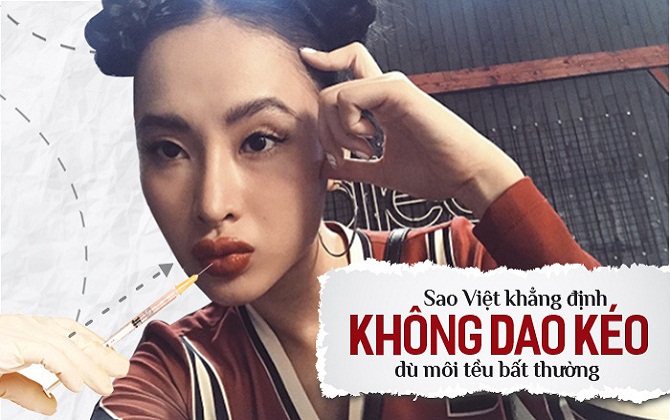 Cứ bơm môi cho căng thế này, chẳng trách sao Việt cứ như 1 người khác