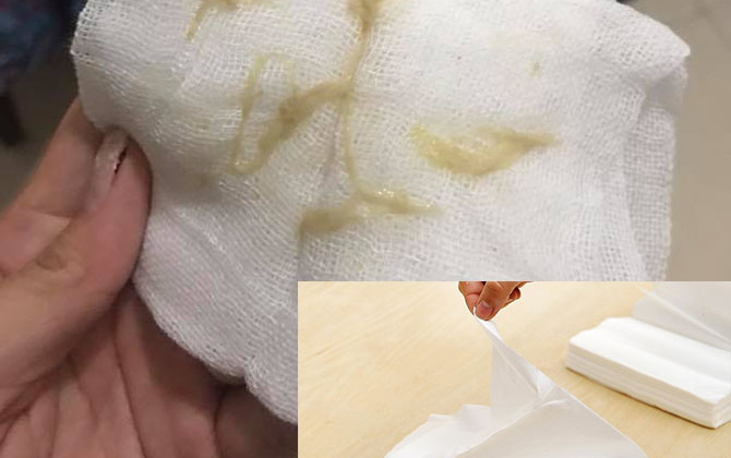 Con đột ngột tím tái, cha mẹ không biết lý do gì nhưng ai cũng giật mình khi biết chẩn đoán của bác sĩ