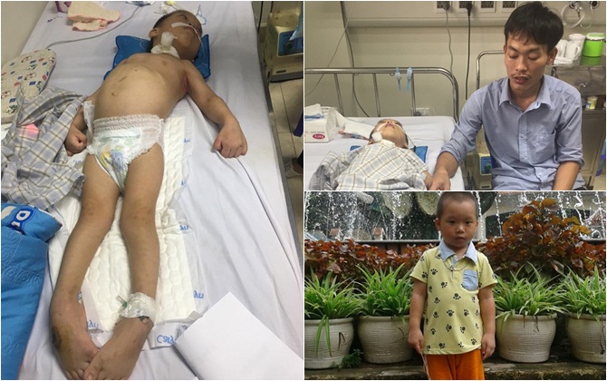 Thực hư tin đồn gia đình bé trai 5 tuổi bị bại não có nhà bên ngoại giàu có, không cần kêu gọi hỗ trợ