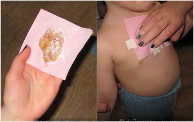 Chỉ bằng miếng dán mật ong tự chế, bà mẹ này đã chữa khỏi ho cho con sau 4 giờ