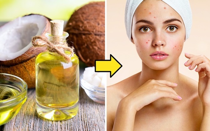 11 mẹo làm đẹp hot rầm rộ trên mạng nhưng lại gây hại không ngờ