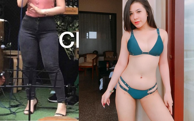 Cô giáo 9X nóng bỏng, hot nhất mạng xã hội 'mạnh tay' chi 119 triệu đồng, chịu nhiều đau đớn làm thẩm mỹ cải thiện đôi chân to