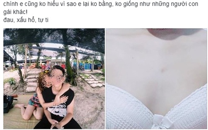 Cô gái đau đớn, tự ti khi bị mối tình đầu chia tay vì ngực lép kèm lời nhắn nhủ: "Hãy để người khác biết ngay từ đầu còn tránh..."