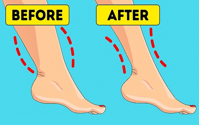Lý do khiến mắt cá chân bị sưng và cách trị dứt điểm vấn đề này