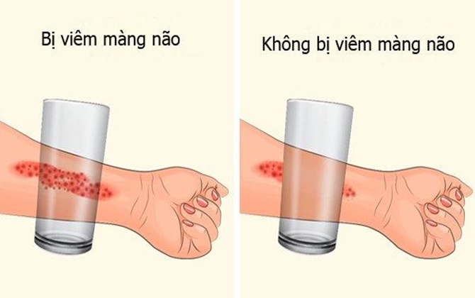 Ngày hè nóng nực, thấy trẻ có những biểu hiện này cần gặp bác sĩ ngay kẻo muộn