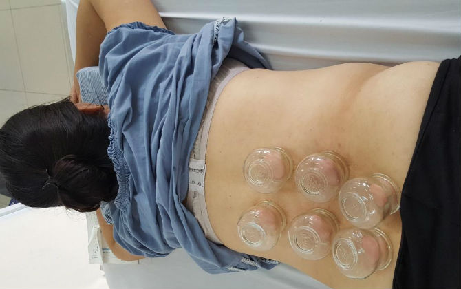 Phương pháp điều trị đau cột sống lưng hiệu quả, không cần dùng thuốc nhưng không được tự tiện làm