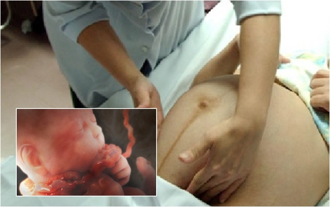 Bầu 9 tháng sắp sinh thai vẫn CHẾT LƯU trong bụng vì những nguyên nhân không ngờ này, mẹ cẩn thận nhé!