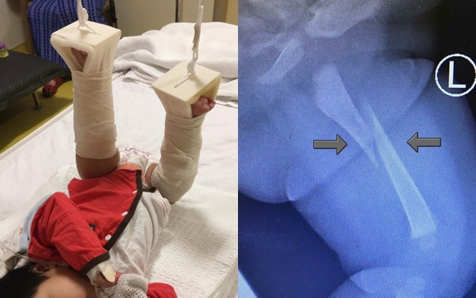 Đón con 3 tháng tuổi từ nhà bảo mẫu, bố mẹ trào nước mắt khi phát hiện sự thật kinh hãi