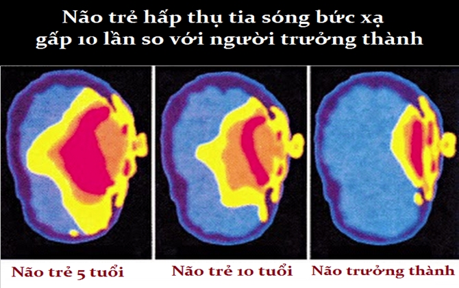 Xem hình ảnh này chắc chắn cha mẹ nào cũng hoảng sợ vì lâu nay cho con tiếp xúc sóng wi-fi quá nhiều!