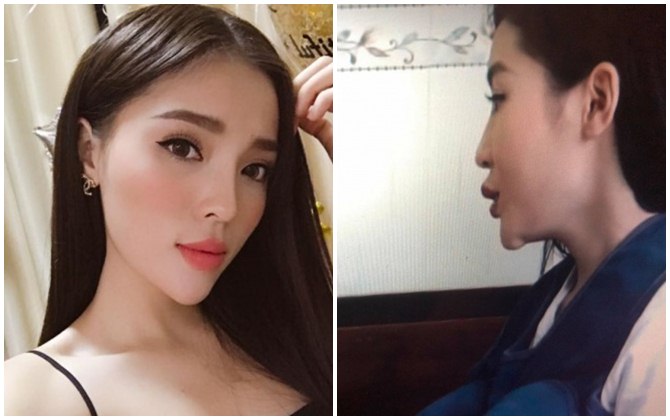 Luôn phủ nhận dao kéo, Hoa hậu Kỳ Duyên để lộ cằm nhọn bất thường trên sóng truyền hình