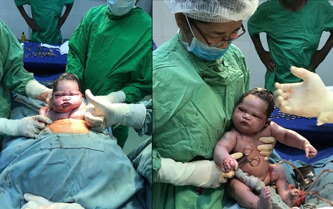Đang ngủ ngon lành trong bụng mẹ bị lôi ra, vẻ mặt thách thức của em bé gây bão mạng