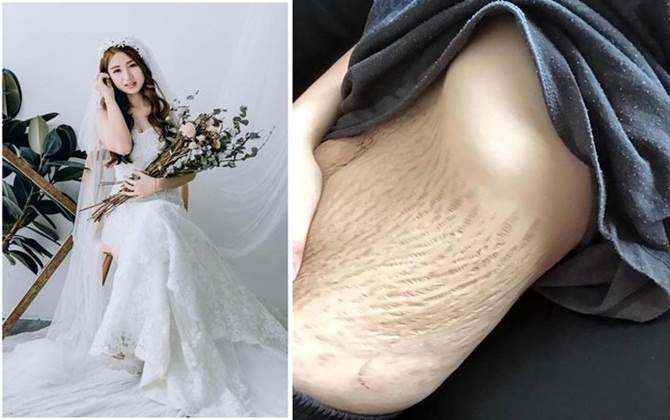 Ra khỏi phòng sinh 4 con, mỹ nhân bụng rạn nát tươm bật khóc: “Hãy trả lại bụng cho em!”