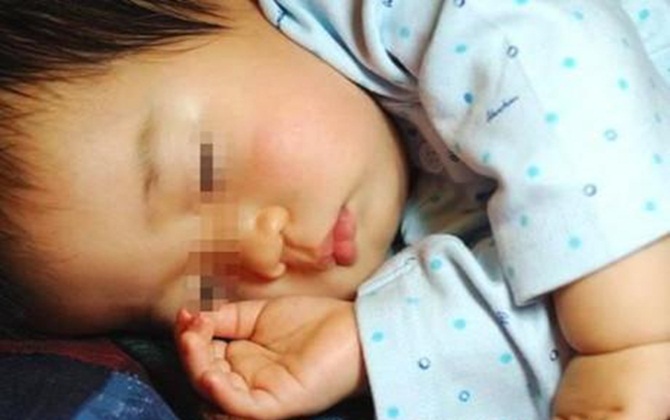 Bé 1,5 tuổi đang chơi bỗng lăn đùng ra đất, phim chụp X-quang khiến ai cũng rùng mình