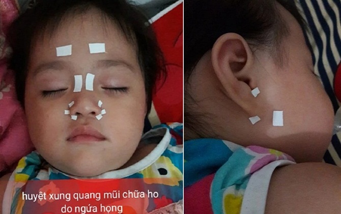 Mẹ áp dụng mẹo THẦN THÁNH Này, con hết hẳn HO – SỔ MŨI chỉ sau 1 đêm, mẹ lưu lại ngay!