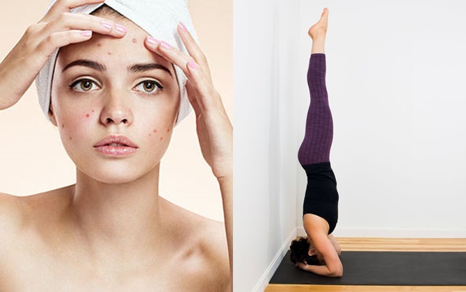 Chẳng cần dùng mỹ phẩm bạn vẫn có thể đánh bay mụn trứng cá bằng 4 tư thế yoga siêu đơn giản