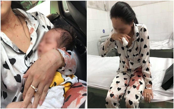 Đau lòng phận bỉm sữa mới sinh được 1 tháng bị chồng đánh máu me đầy người, vẫn cố ôm con đến bệnh viện