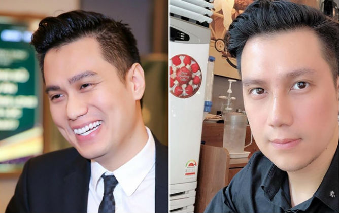 Vẻ ngoài của diễn viên Việt Anh biến đổi sau phẫu thuật thẩm mỹ