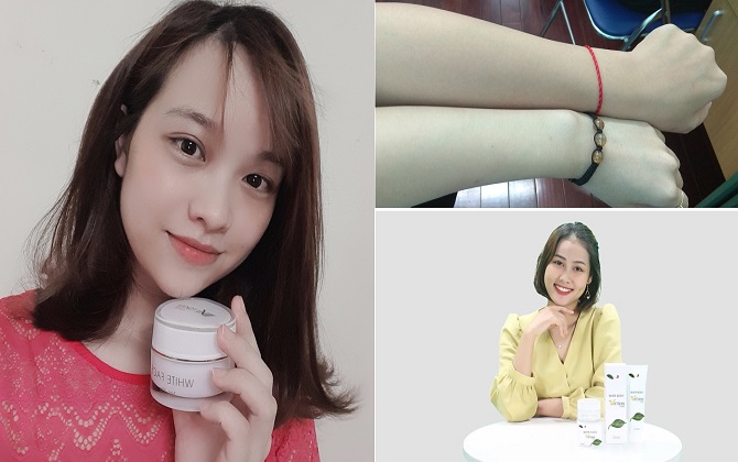 Chỉ 1,5 tháng, em đã lấy lại làn da trắng sau khi bị sạm đen vì ham đi bơi, đi biển