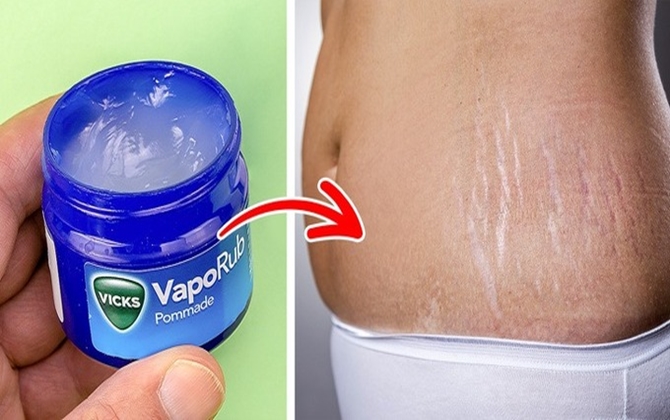 8 món đồ bình dân hiệu quả ngang mỹ phẩm cao cấp