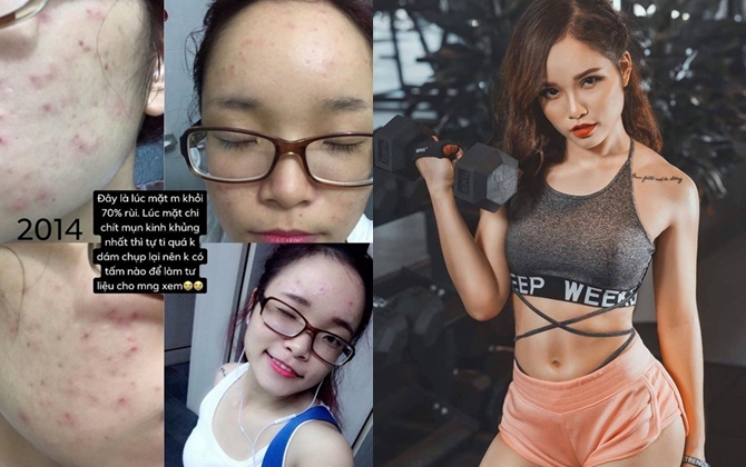 Kinh nghiệm trị mụn, chăm da bóng khỏe của hot gymer nóng bỏng ai nhìn cũng mê mẩn, thán phục