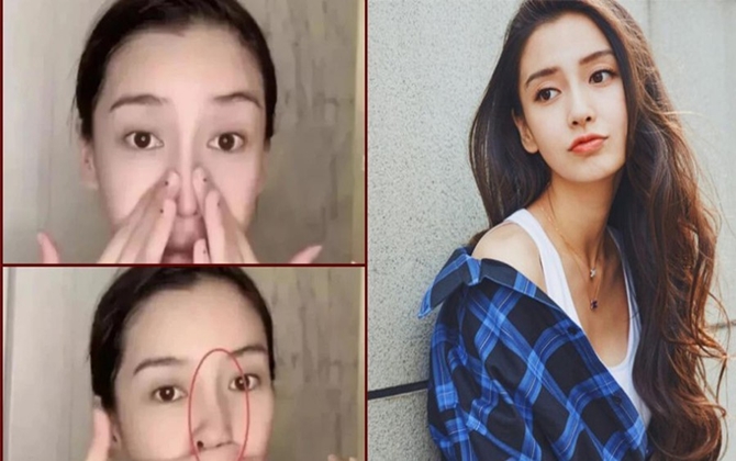 Angelababy bị lộ di chứng thẩm mỹ khi mũi bị vẹo lúc livestream?