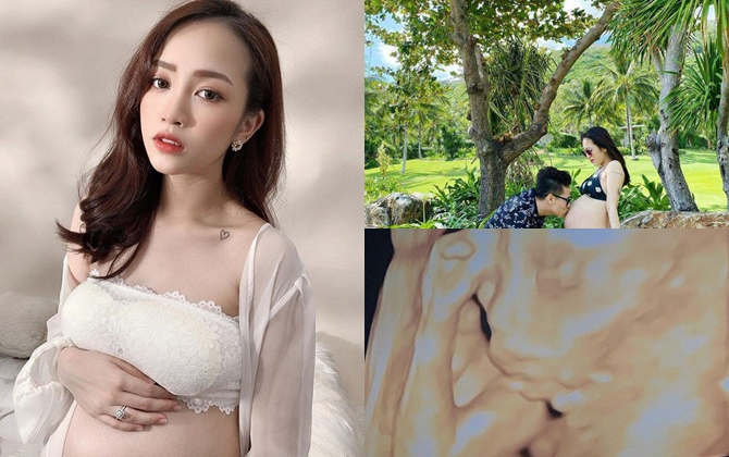Ghen tỵ mẹ bầu "rich kid" sinh ra ở vạch đích, sở hữu "nhan sắc đỉnh cao" khiến dân mạng phải trầm trồ