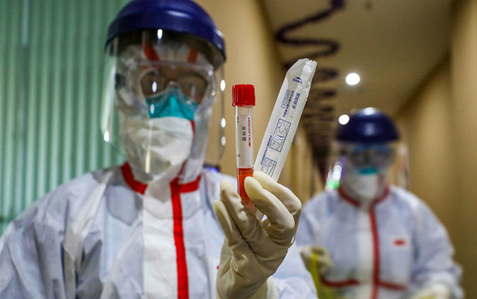 Nếu mang nhóm máu này, bạn dễ nhiễm virus Covid-19 hơn những người khác