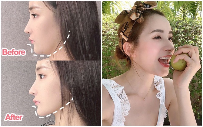 3 động tác massage đơn giản, dễ như ăn kẹo "xóa bay" cằm nọng, má núng nính chẳng cần phẫu thuật