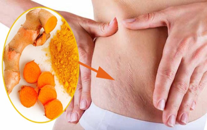 Loanh quanh góc bếp cũng tìm được đủ nguyên liệu tự nhiên để chị em trị rạn da sau sinh