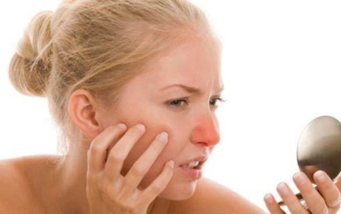 5 thay đổi trên gương mặt tố cáo tình trạng sức khỏe của bạn đang ngày một tồi tệ