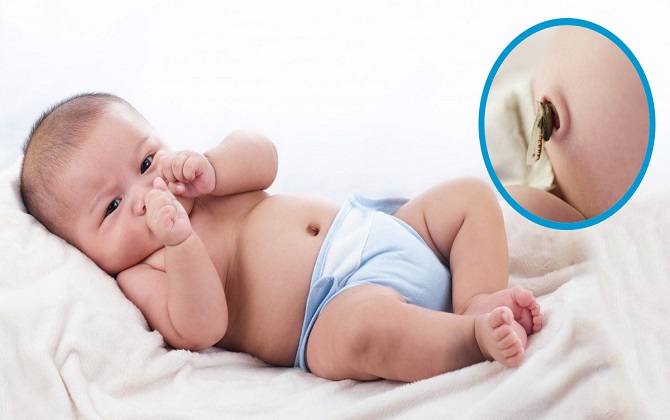 Dấu hiệu ở rốn cảnh báo trẻ sơ sinh đang gặp nguy hiểm, thấy con gặp phải cha mẹ nên cho đi khám ngay