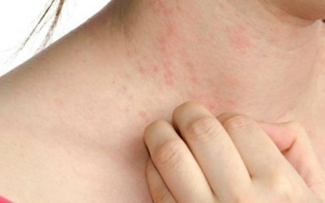 Ngứa 5 vị trí này trên cơ thể cảnh báo đang mắc bệnh nguy hiểm đi khám ngay kẻo nặng