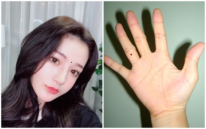 3 nốt ruồi báo hiệu kinh doanh vượng phát, đầu tư đâu, sinh lời đó