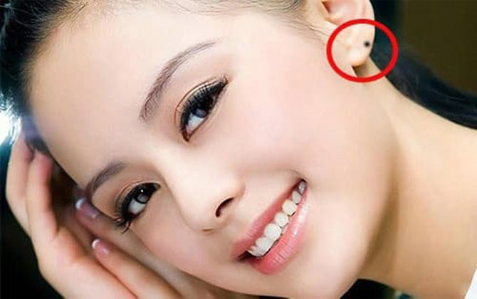 7 nốt ruồi đại phú quý, báo hiệu một đời giàu sang, không lo tiền bạc