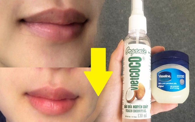 Tip trị thâm môi hiệu quả vô địch: Chỉ cần Vaseline và dầu dừa mà môi hồng hào, không makeup vẫn xinh tươi