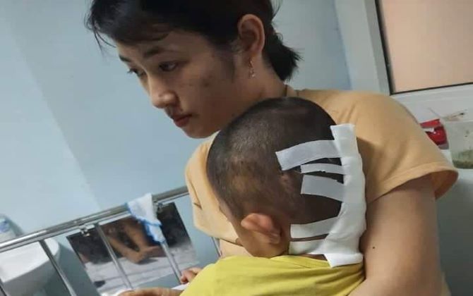 Lời khẩn cầu của người mẹ bất hạnh có con trai 5 tuổi mắc bệnh u não không tiền cứu chữa