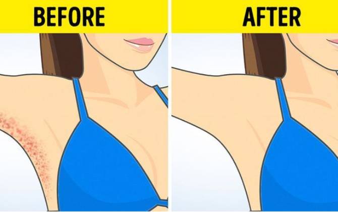 5 mẹo làm đẹp hữu ích trong tình huống khẩn cấp
